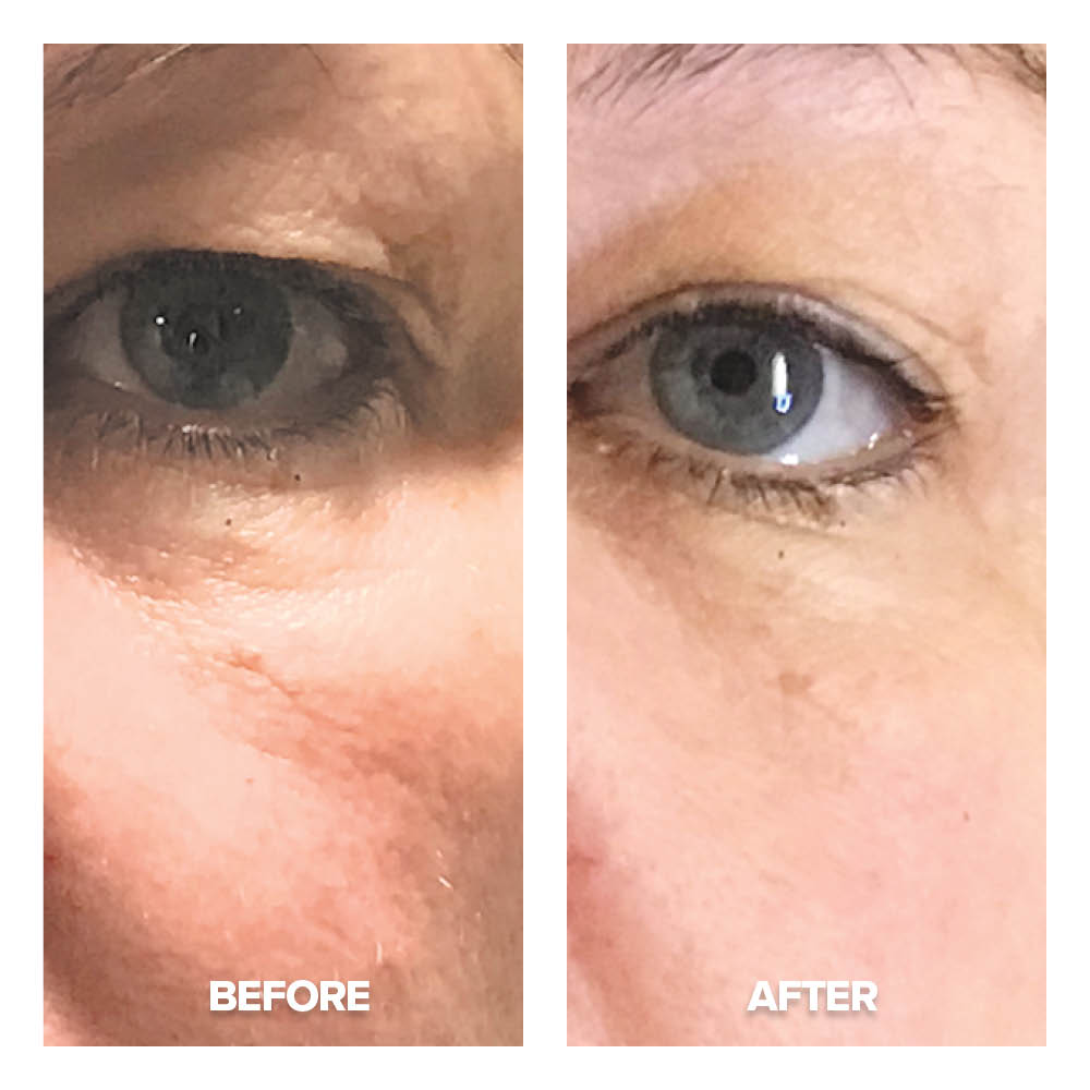 Instant Tensor Serum - Single Purchase 3 Instant Tensor Serum - product detail 3